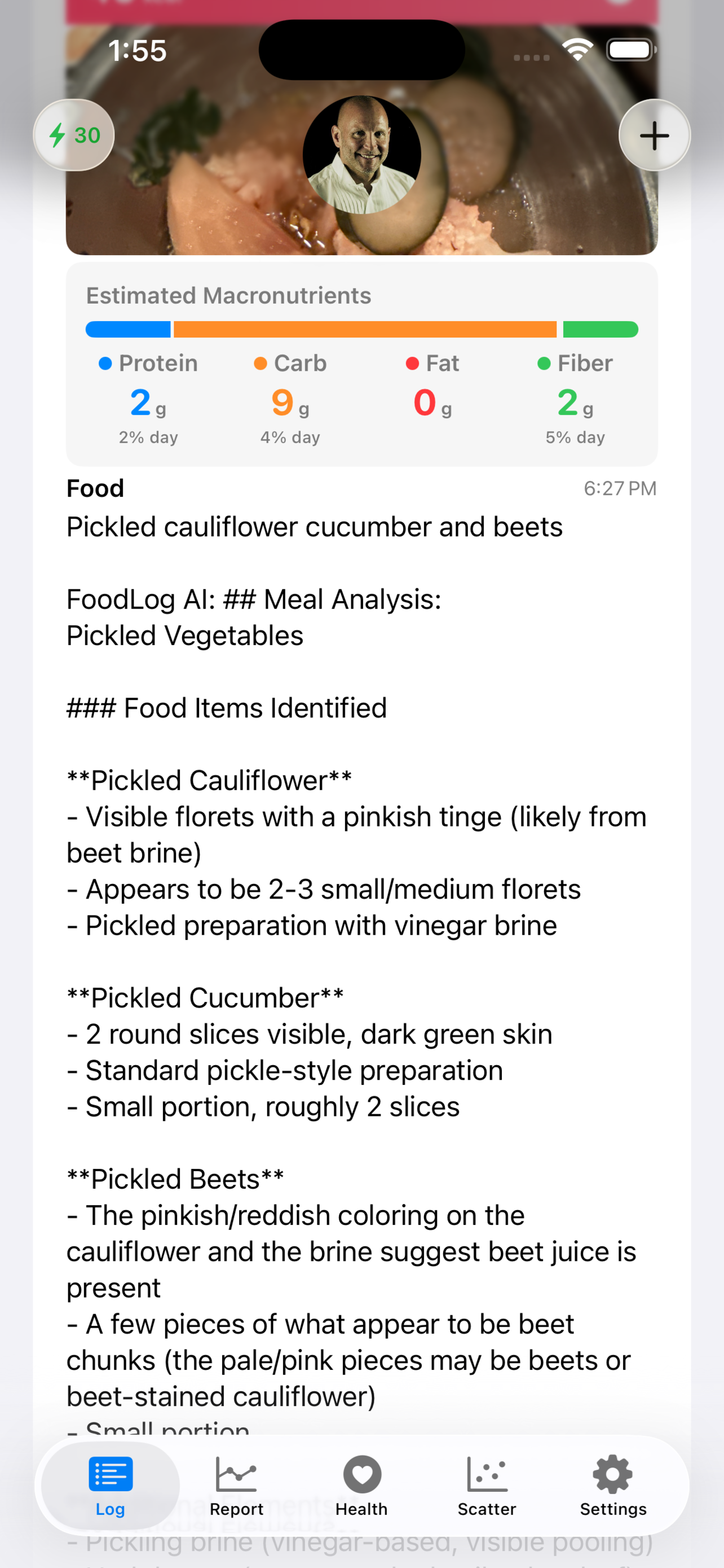 AI food analysis details