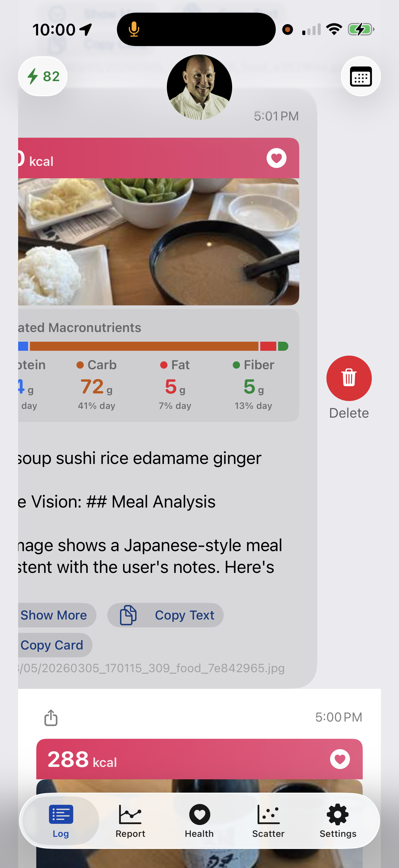 Delete entry swipe action from food log card