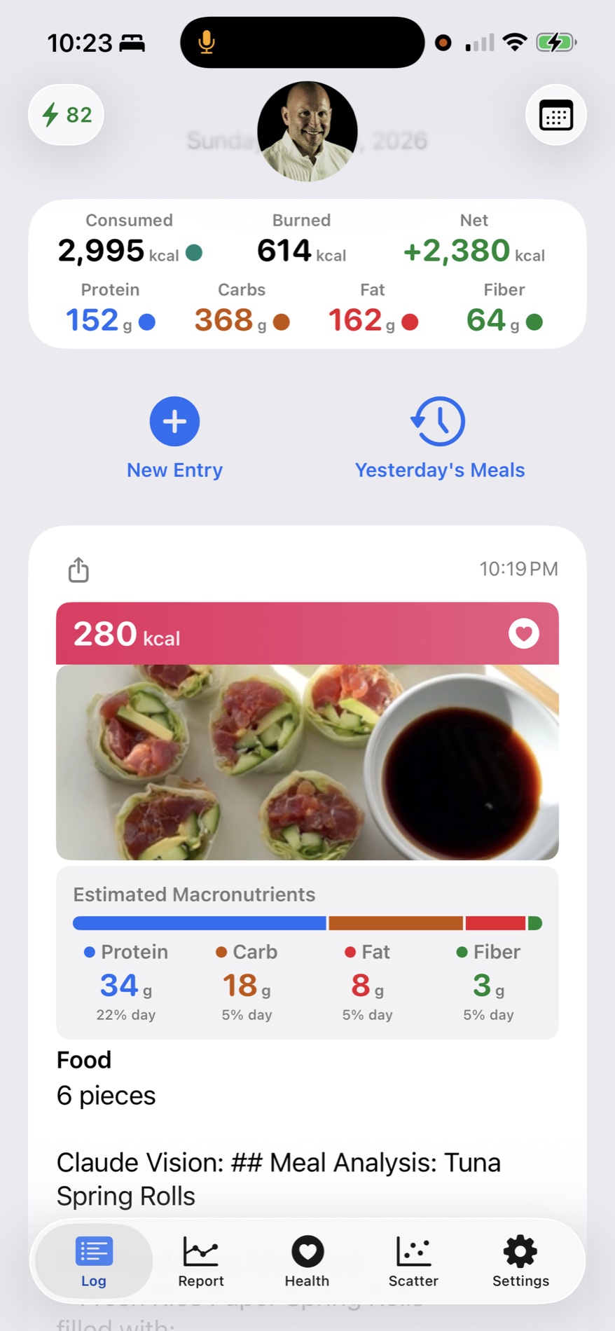 Food log card with meal image and macro estimates